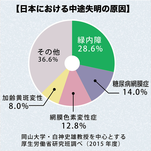 イラストで詳細に解説。緑内障とは!