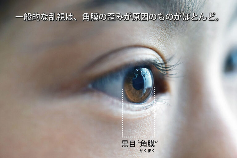 乱視とは?イラストで詳細に解説、乱視チェック - 視力回復ブログ