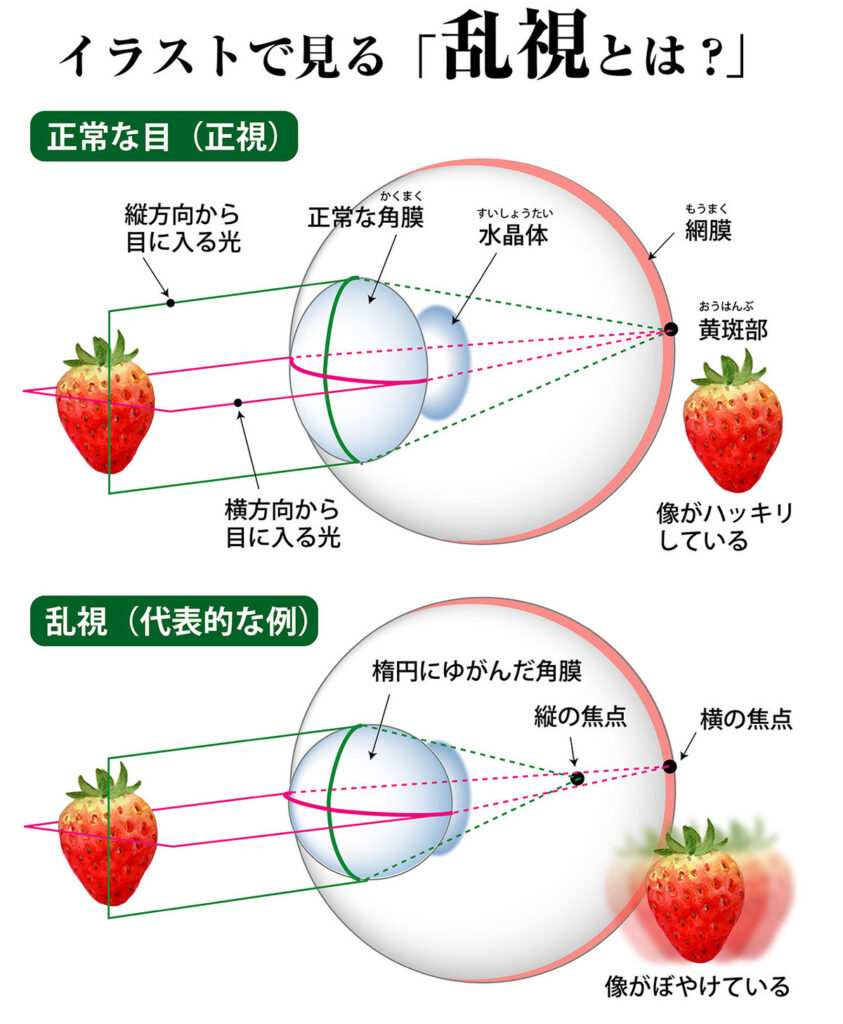 乱視とは?イラストで詳細に解説、乱視チェック - 視力回復ブログ