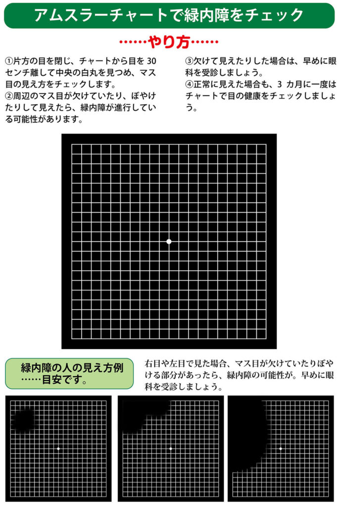 イラストで詳細に解説。緑内障とは!