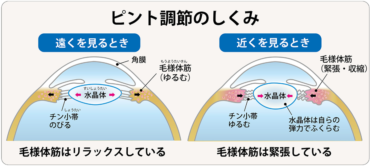 働く女性の目の悩み……対策と解消方法!