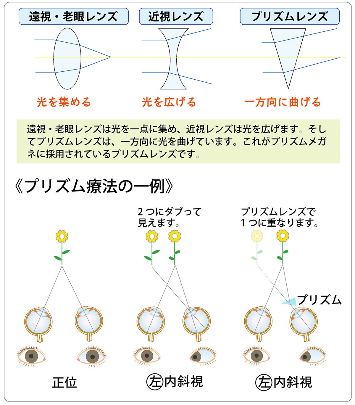 スマホの見過ぎで急性内斜視（スマホ内斜視）になる?!