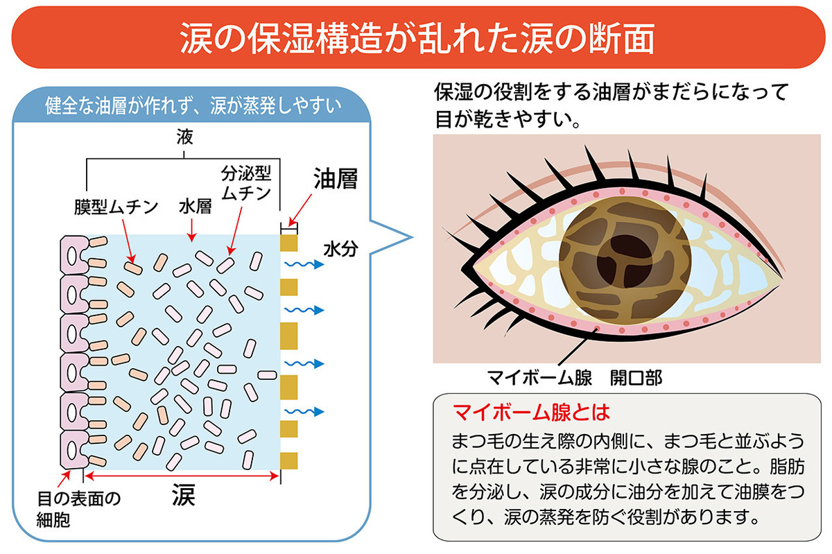 働く女性の目の悩み……対策と解消方法!