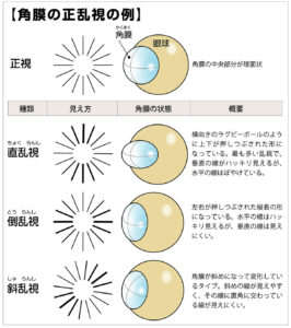 乱視とは?イラストで詳細に解説、乱視チェック - 視力回復ブログ