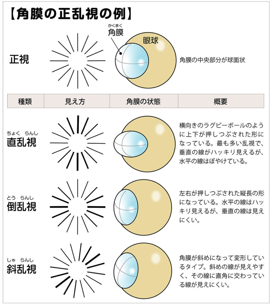 乱視 と は 見え 方 – 乱視の人の見え方 – 視力と度数の意味とは?自分にあった度数を決めるには – OCTAO
